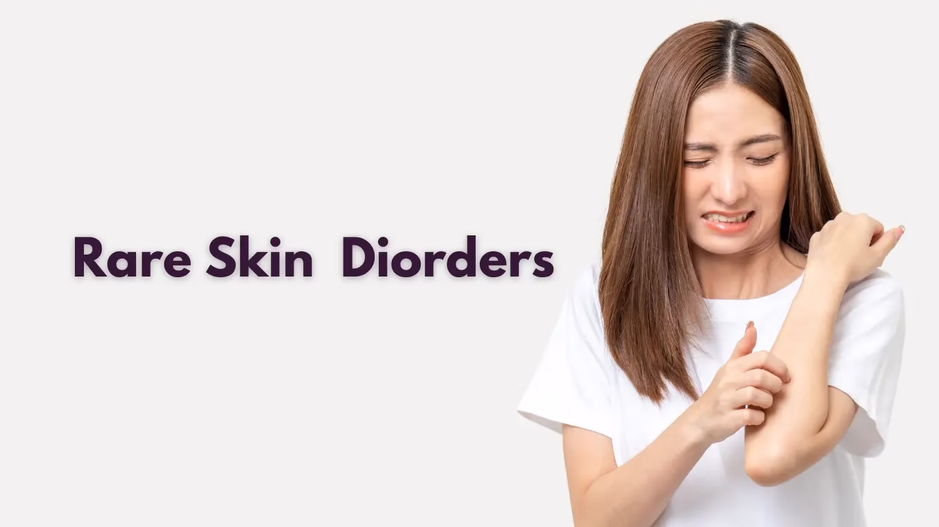 Rare Skin Disorders